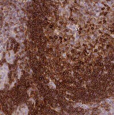 Immunohistochemistry-Paraffin: CXCR5 Antibody [NBP2-48763]