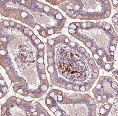 Immunohistochemistry-Paraffin: CXCR5 Antibody [NBP2-48763]
