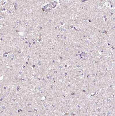 Immunohistochemistry-Paraffin: CXCR5 Antibody [NBP2-48763]