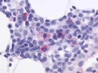Immunohistochemistry-Paraffin: CXCR5 Antibody - BSA Free [NLS1385]