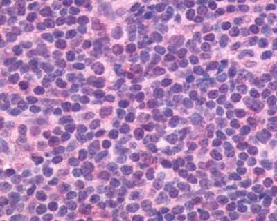 Immunohistochemistry-Paraffin: CXCR5 Antibody - BSA Free [NLS1385]