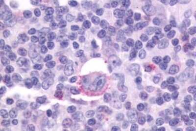 Immunohistochemistry-Paraffin: CXCR5 Antibody - BSA Free [NLS1385]