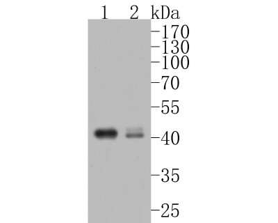 Western Blot: CXCR5 Antibody (JB11-40) [NBP2-75460]
