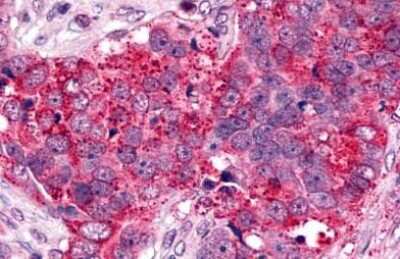 Immunohistochemistry-Paraffin: CXCR6 Antibody - BSA Free [NLS1102]