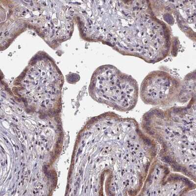 Immunohistochemistry-Paraffin: CXCR7/RDC-1 Antibody [NBP2-13885]