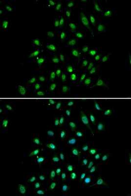 Immunocytochemistry/ Immunofluorescence: CXXC1 Antibody - BSA Free [NBP2-92895]