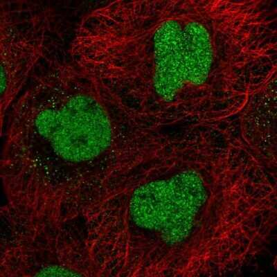 Immunocytochemistry/ Immunofluorescence: CXXC5 Antibody [NBP2-58775]