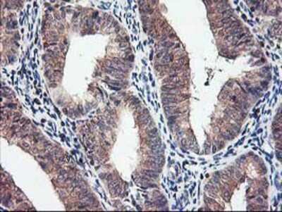 Immunohistochemistry-Paraffin: PBDC1 Antibody (OTI4E11) [NBP2-00929]