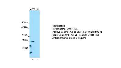 Western Blot: CXorf40A Antibody [NBP2-82786]