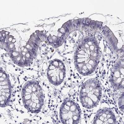 Immunohistochemistry-Paraffin: PIH1D3 Antibody [NBP2-62677]