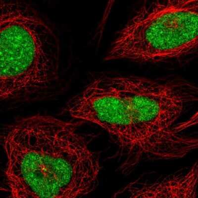 Immunocytochemistry/ Immunofluorescence: CXorf56/MRX107 Antibody [NBP2-57638]