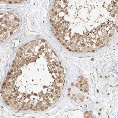 Immunohistochemistry-Paraffin: CXorf58 Antibody [NBP2-48612]