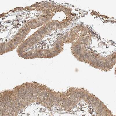 Immunohistochemistry-Paraffin: CXorf58 Antibody [NBP2-48612]