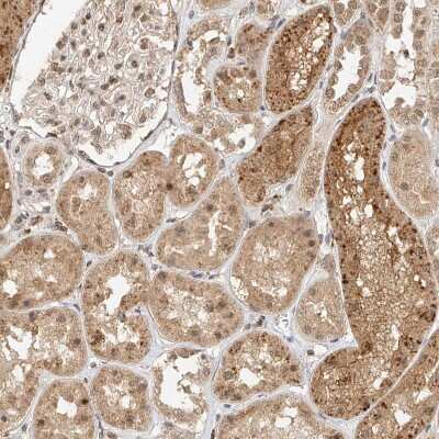 Immunohistochemistry-Paraffin: CXorf58 Antibody [NBP2-48612]