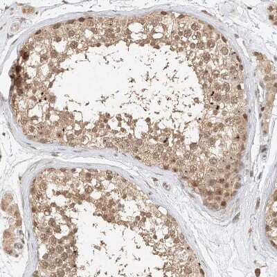 Immunohistochemistry-Paraffin: CXorf58 Antibody [NBP2-48612]
