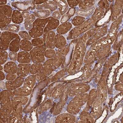 Immunohistochemistry-Paraffin: PRR32 Antibody [NBP2-14639]