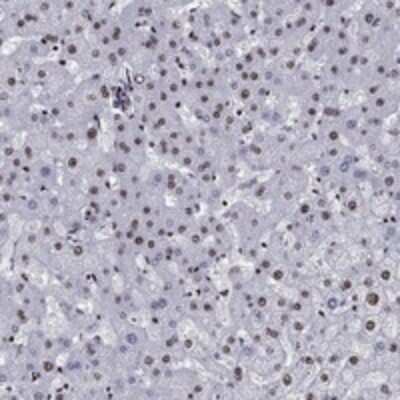 Immunohistochemistry-Paraffin: CYB561D2 Antibody [NBP3-17237]