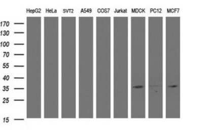 Western Blot: CYB5R1 Antibody (OTI2D10) [NBP2-45649]