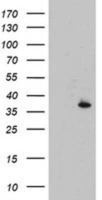 Western Blot: CYB5R1 Antibody (OTI4B7) [NBP2-01951]