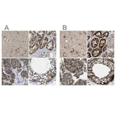 Immunohistochemistry-Paraffin: CYB5R1 Antibody [NBP1-83144]