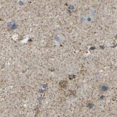 Immunohistochemistry-Paraffin: CYB5R1 Antibody [NBP1-83144]