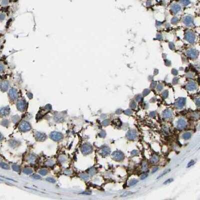 Immunohistochemistry-Paraffin: CYB5R1 Antibody [NBP1-83144]