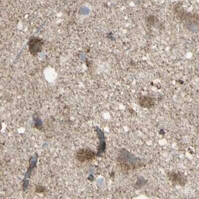 Immunohistochemistry-Paraffin: CYB5R1 Antibody [NBP1-83145]