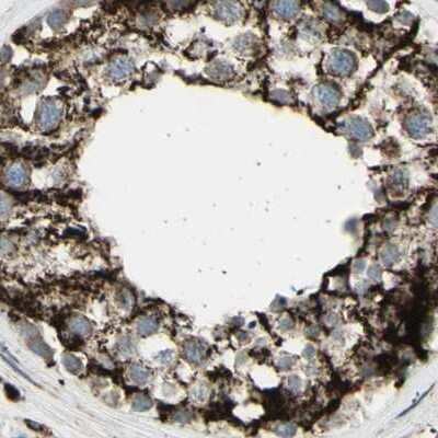 Immunohistochemistry-Paraffin: CYB5R1 Antibody [NBP1-83145]