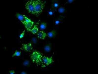 Immunocytochemistry/ Immunofluorescence: CYB5R1 Antibody (OTI4B7) - Azide and BSA Free [NBP2-71943]