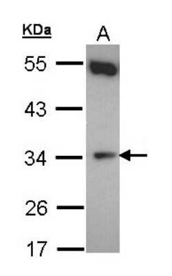 Western Blot: CYB5R1 Antibody [NBP1-32276]