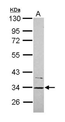 Western Blot: CYB5R1 Antibody [NBP2-16047]