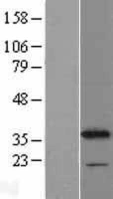 Western Blot: CYB5R1 Overexpression Lysate [NBL1-09653]