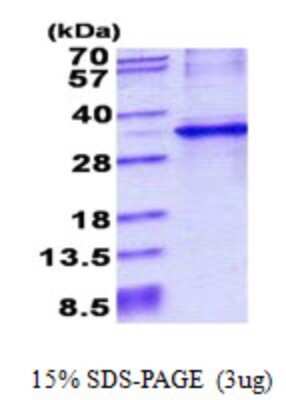 SDS-PAGE: Recombinant Human CYB5R1 His Protein [NBP2-22980]