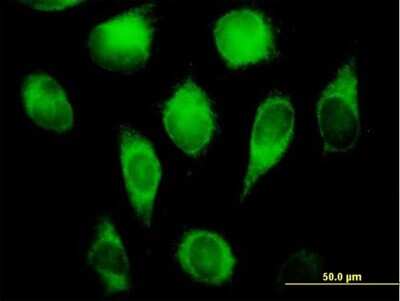 Immunocytochemistry/ Immunofluorescence: CYB5R3 Antibody [H00001727-B01P]