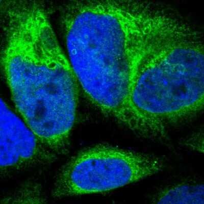 Immunocytochemistry/ Immunofluorescence: CYB5R3 Antibody [NBP1-84252]