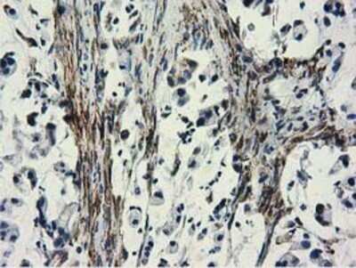 Immunohistochemistry: CYB5R3 Antibody (OTI2A10) - Azide and BSA Free [NBP2-70572]