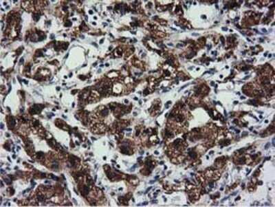Immunohistochemistry: CYB5R3 Antibody (OTI2A10) - Azide and BSA Free [NBP2-70572]