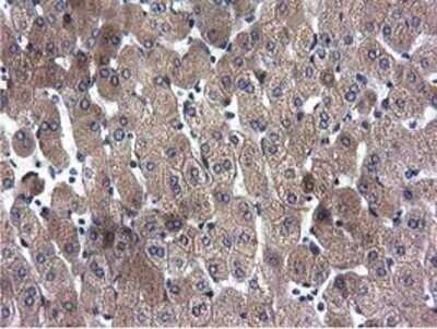 Immunohistochemistry: CYB5R3 Antibody (OTI2A10) - Azide and BSA Free [NBP2-70572]