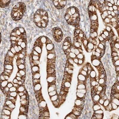 Immunohistochemistry-Paraffin: CYB5R4 Antibody [NBP1-88957]