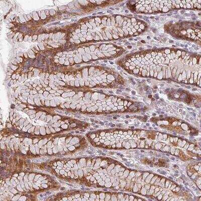 Immunohistochemistry-Paraffin: CYB5RL Antibody [NBP2-13889]