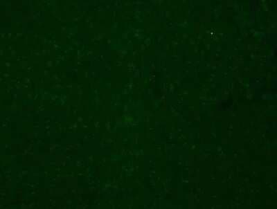Immunohistochemistry: CYBB/NOX2 Antibody - BSA Free [NBP2-41291]