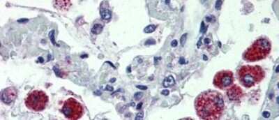 Immunohistochemistry-Paraffin: CYBB/NOX2 Antibody [NBP1-59062]