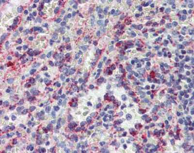 Immunohistochemistry-Paraffin: CYBB/NOX2 Antibody [NBP1-59062]