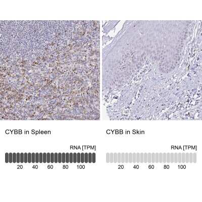Immunohistochemistry-Paraffin: CYBB/NOX2 Antibody [NBP2-38642]