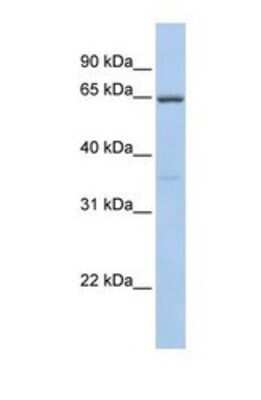 Western Blot: CYBB/NOX2 Antibody [NBP1-59062]