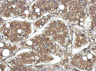 Immunohistochemistry-Paraffin: CYFIP1 Antibody [NBP2-16060]