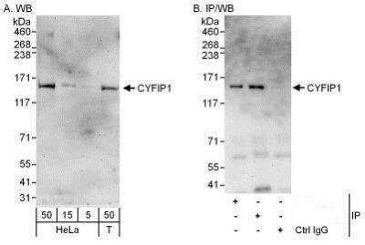 Western Blot: CYFIP1 Antibody [NBP1-50028]