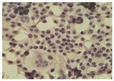 Immunocytochemistry/ Immunofluorescence: CYLD Antibody [NB100-56461]