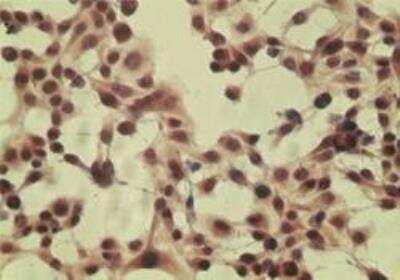 Immunocytochemistry/ Immunofluorescence: CYLD Antibody [NB100-56461]