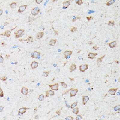 Immunohistochemistry-Paraffin: CYLD Antibody - BSA Free [NBP2-92436]